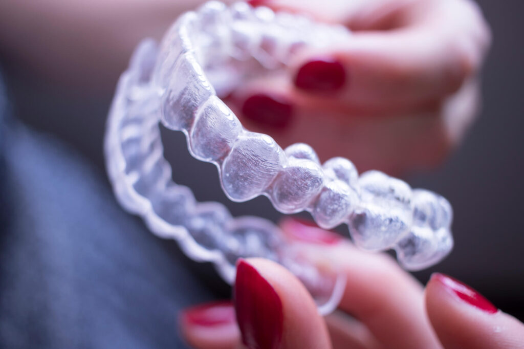 Where to find Clear Braces Encino?