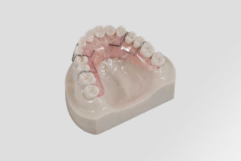 Clear Retainers