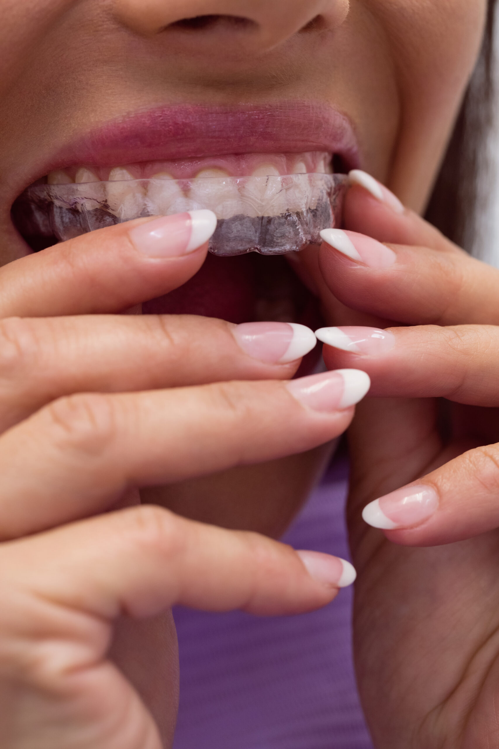 Image of dentist for kids