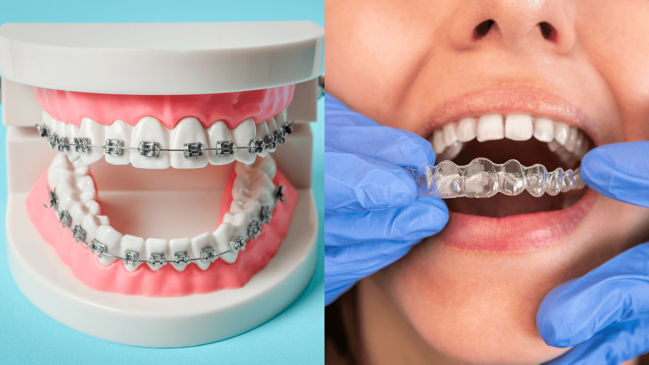 Image of dentist for kids